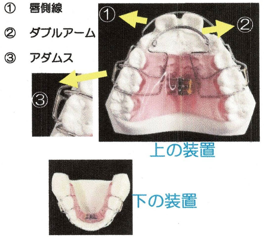 拡大装置の取り扱い1